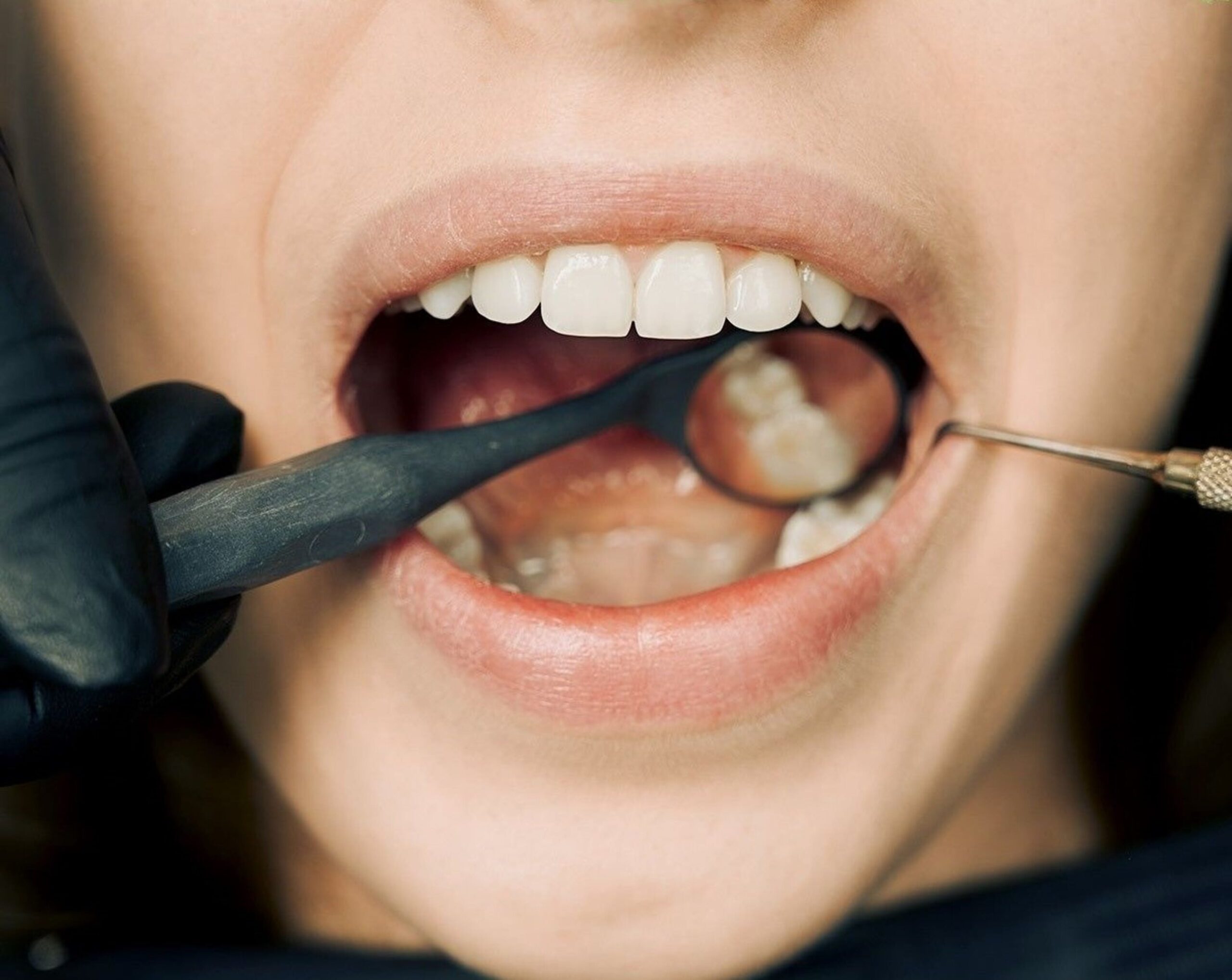 blog clinica dental